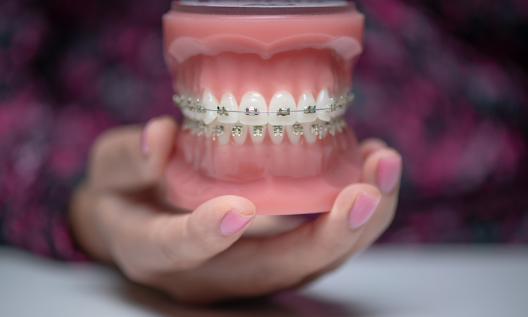 aparat samoligaturujący