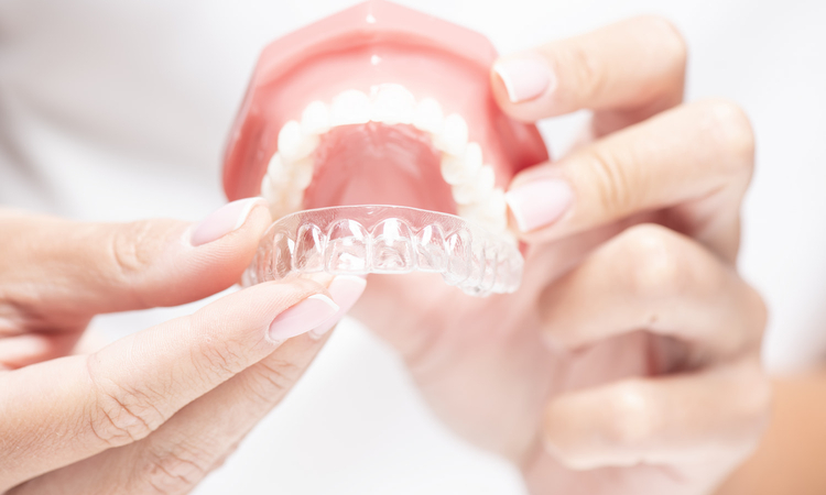 Niewidoczny aparat na zęby