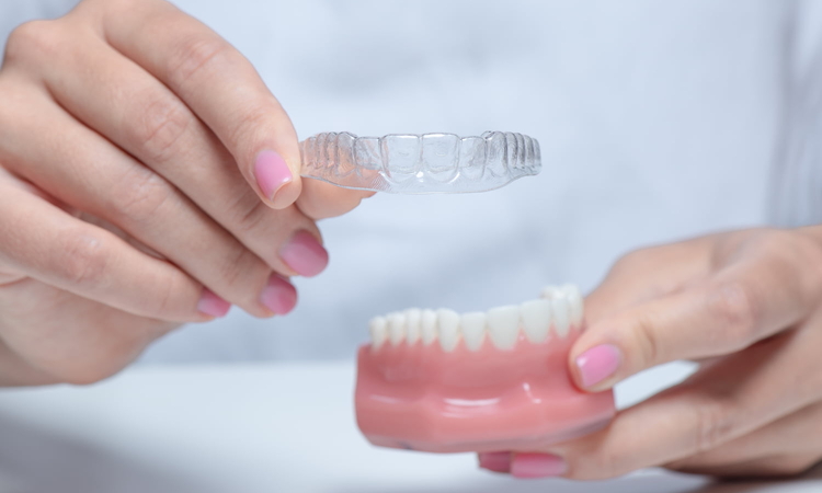 Leczenie nakładkami Leczenie nakładkami