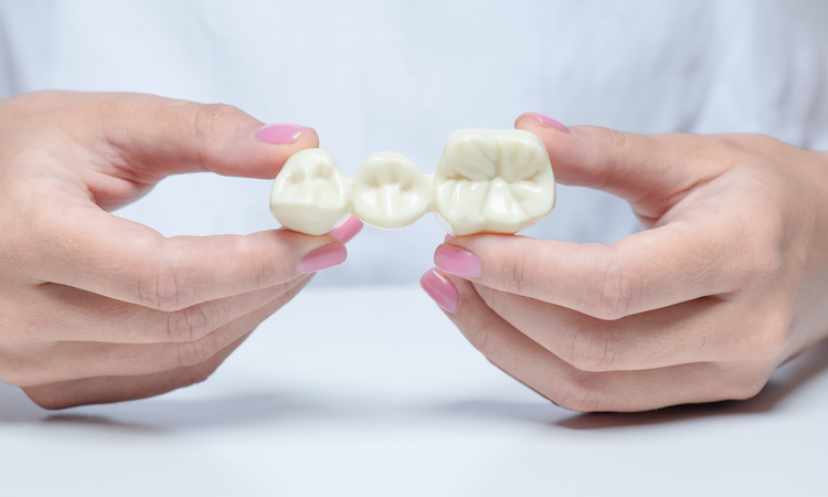 Jak uzupełnić duże braki w uzębieniu? Najskuteczniejsze metody protetyczne Jak uzupełnić duże braki w uzębieniu? Najskuteczniejsze metody protetyczne