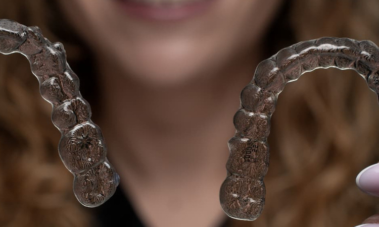 Invisalign – co to 